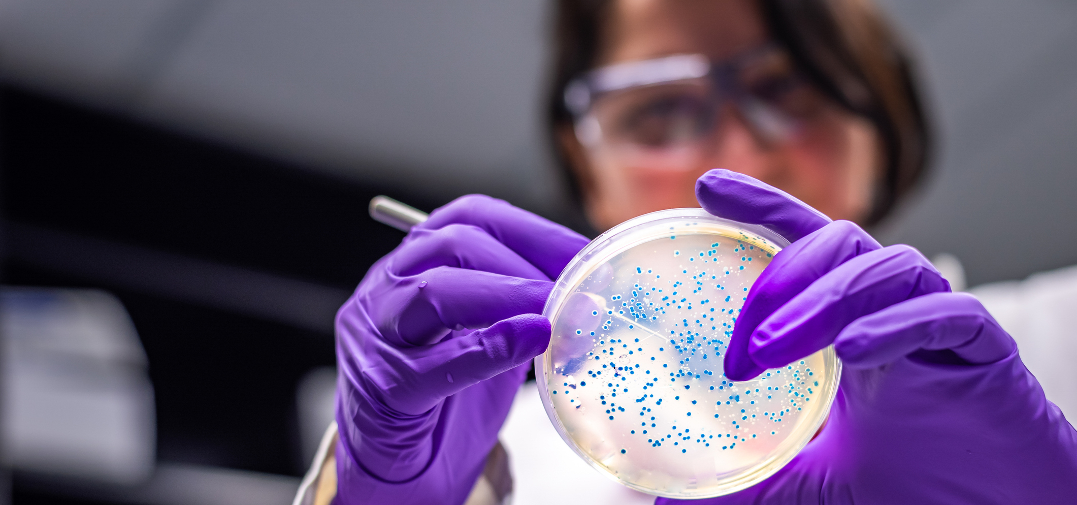 State and local health departments coordinate with CDC as it warns of E